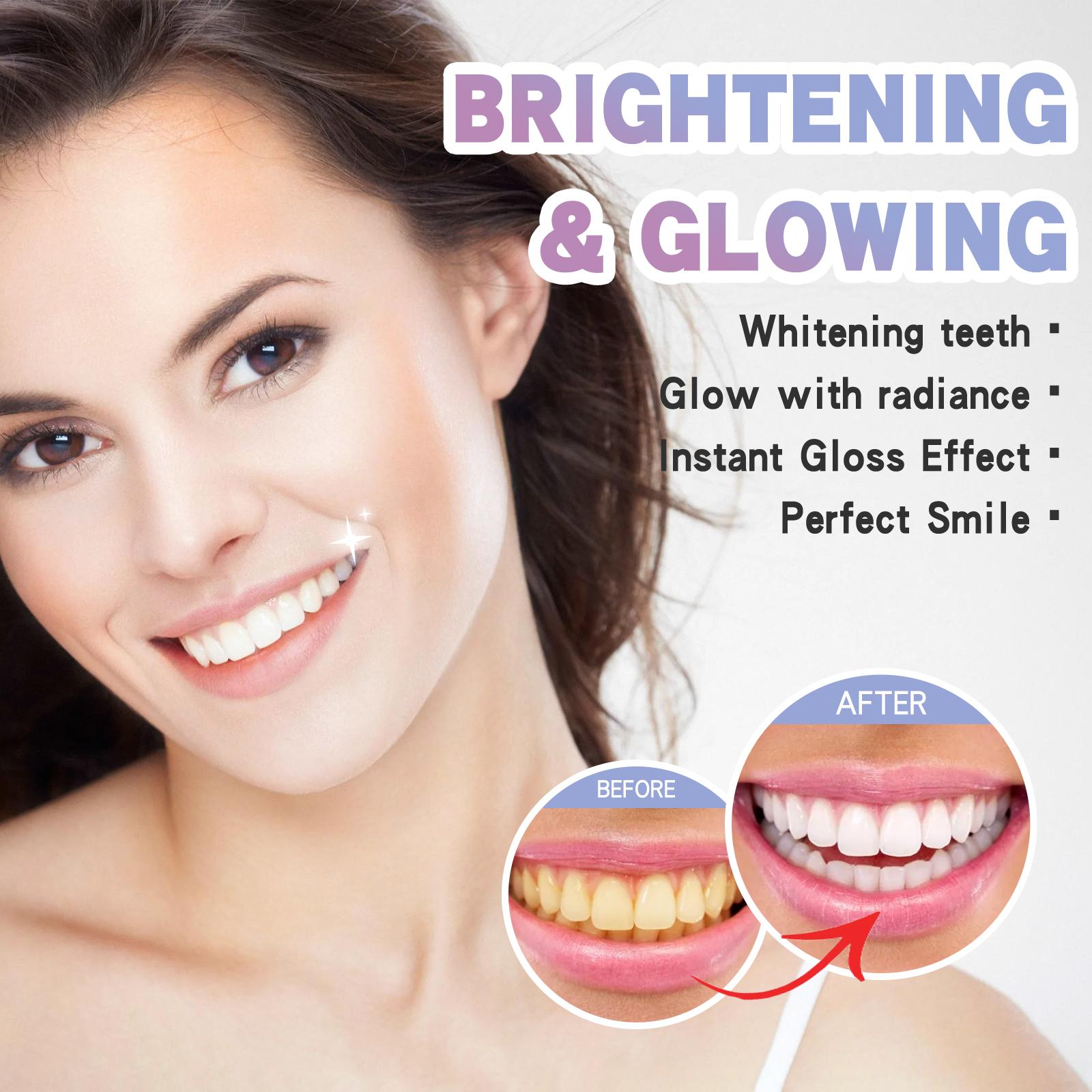 Night Teeth Whitening Pen, Teeth Stain Remover Whitens Teeth